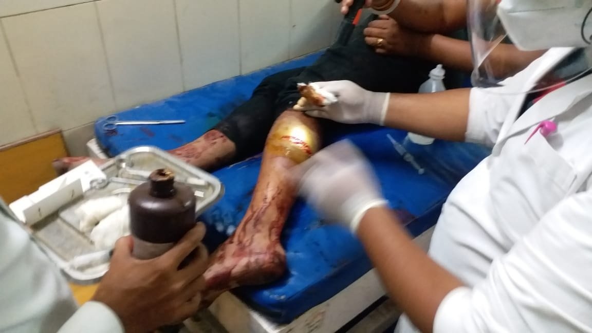 पत्रकार मनोज कुंडू के भाई पर जानलेवा हमला 1 IMG 20210511 WA0002
