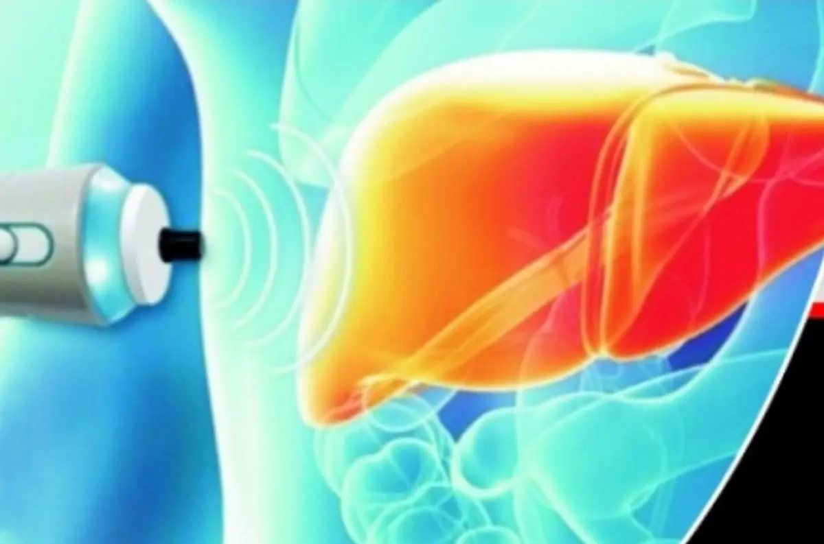 90 percent discount on liver fibroscan test, camp to be held on 25th