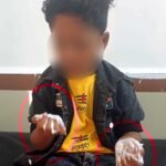 CPE public school student's hand burnt after holding a glass of hot water