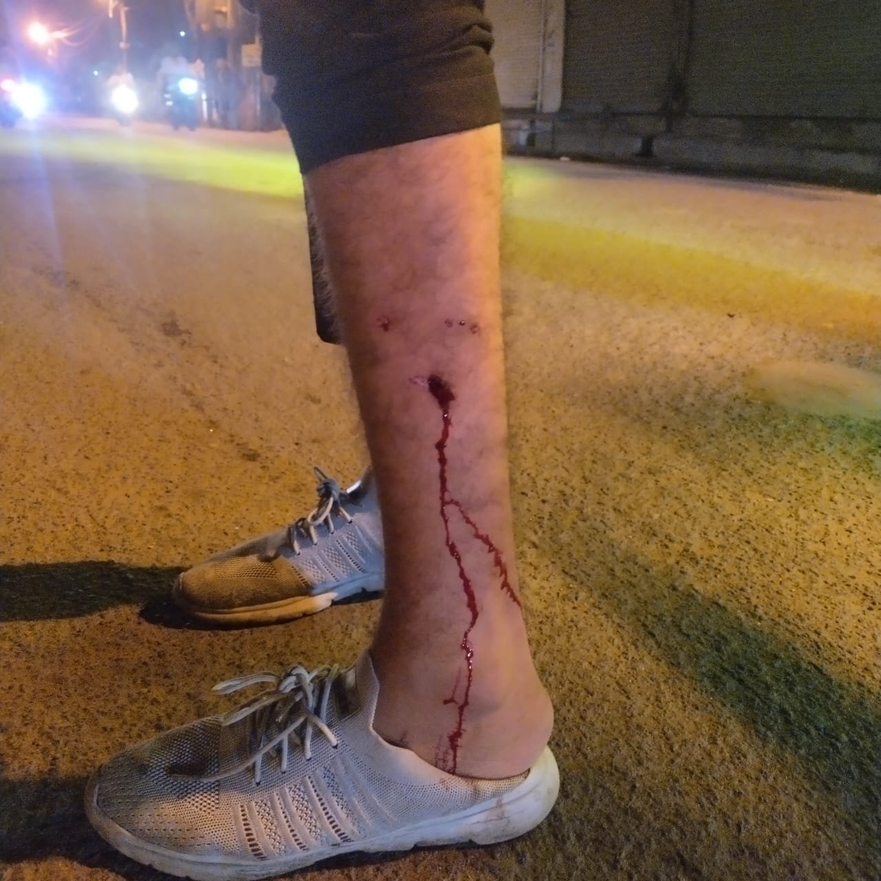 Dogs cause terror, bite more than 20 people, dog lovers create controversy