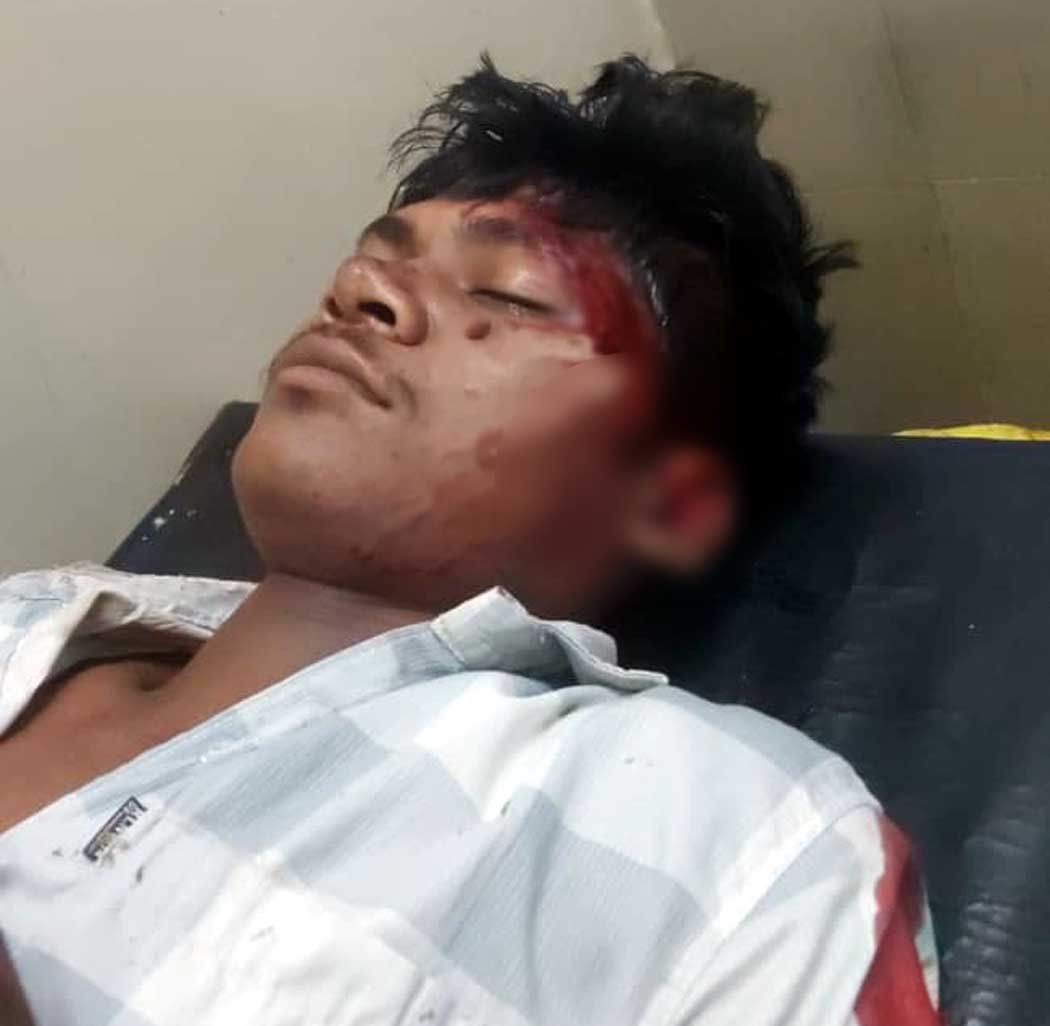 A young man was seriously injured after colliding with a cow and was taken to the hospital by FRV-11.