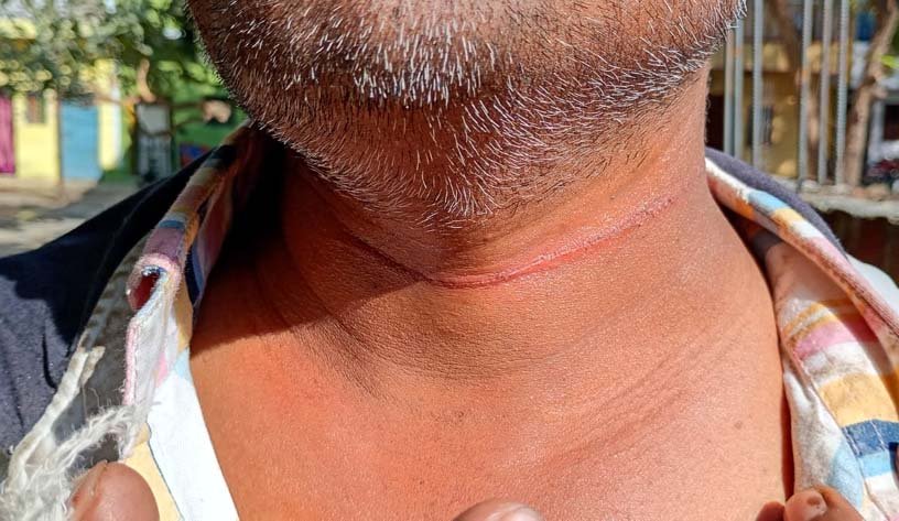 The thread of death and the administration sleeping, when will the 'China door' be controlled in Itarsi?