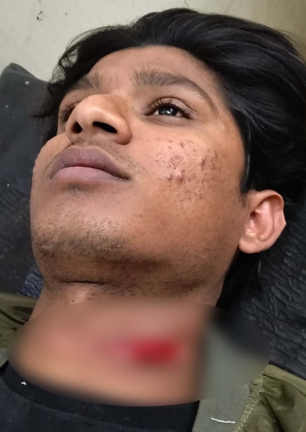 A young man's throat was slit with Chinese thread in front of Bajrang Paan Tap.