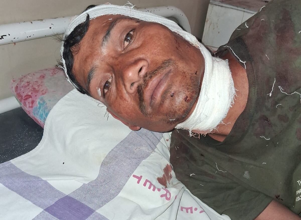 ओवरब्रिज के नीचे सफाईकर्मी पर ब्लेड से जानलेवा हमला, गर्दन पर आए 10 टांके 1 A sanitation worker was attacked with a blade under an overbridge, receiving 10 stitches on his neck.