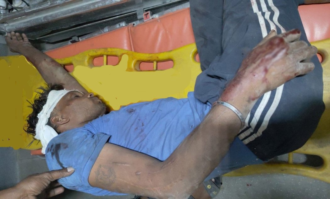 A young man was seriously injured after being hit by a train, but his life was saved by the alertness of 108 personnel.