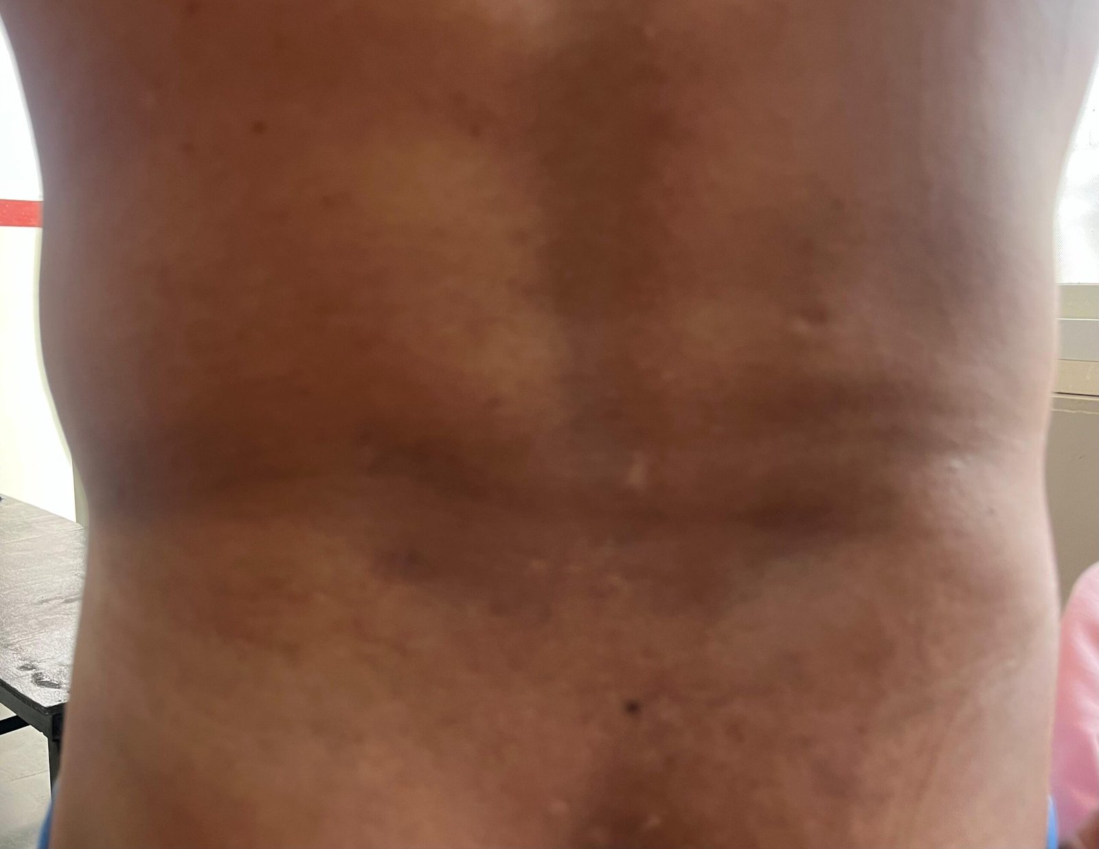 Two tribals were held hostage and electrocuted, FIR demanded