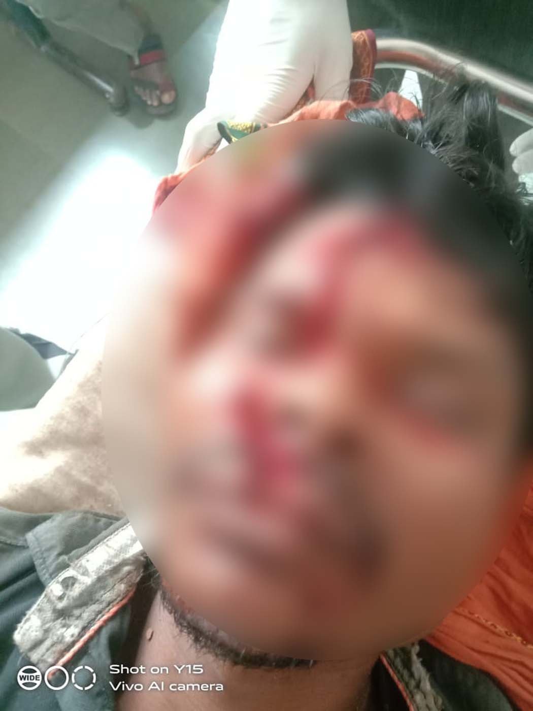 Bear launches a life-threatening attack on a tribal man grazing cows in Kohda forest; referred to Narmadapuram.