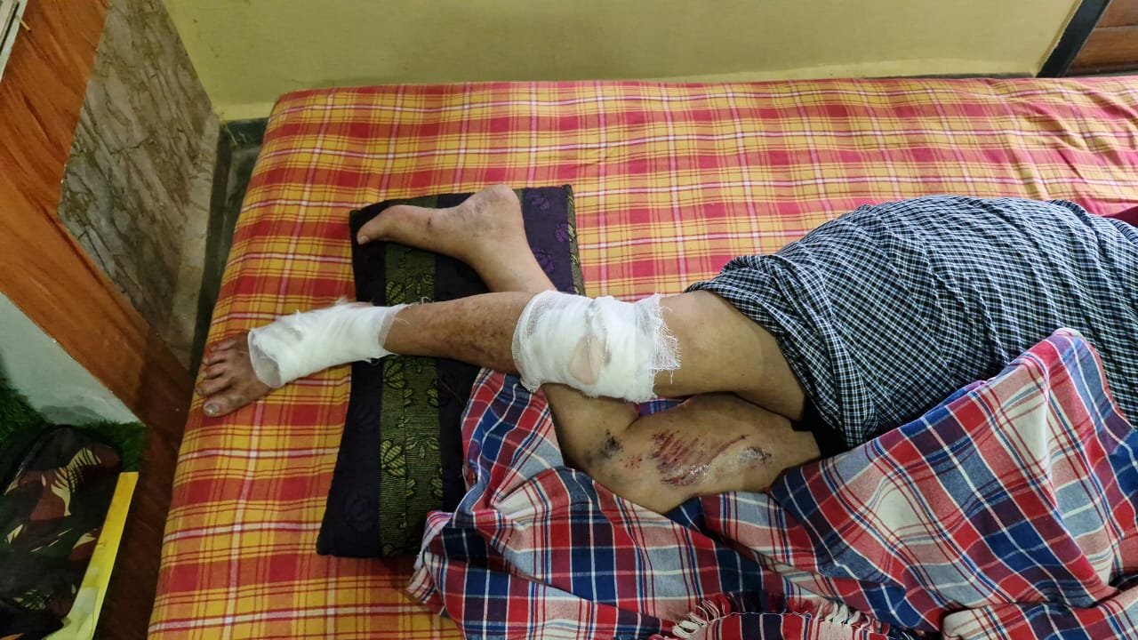 Menace of stray cattle: Social activist critically injured in bull attack; receives 15 stitches.